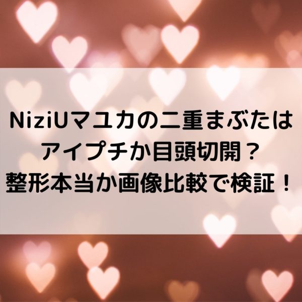 NiziUマユカの二重まぶたはアイプチか目頭切開？整形本当か画像比較で検証！